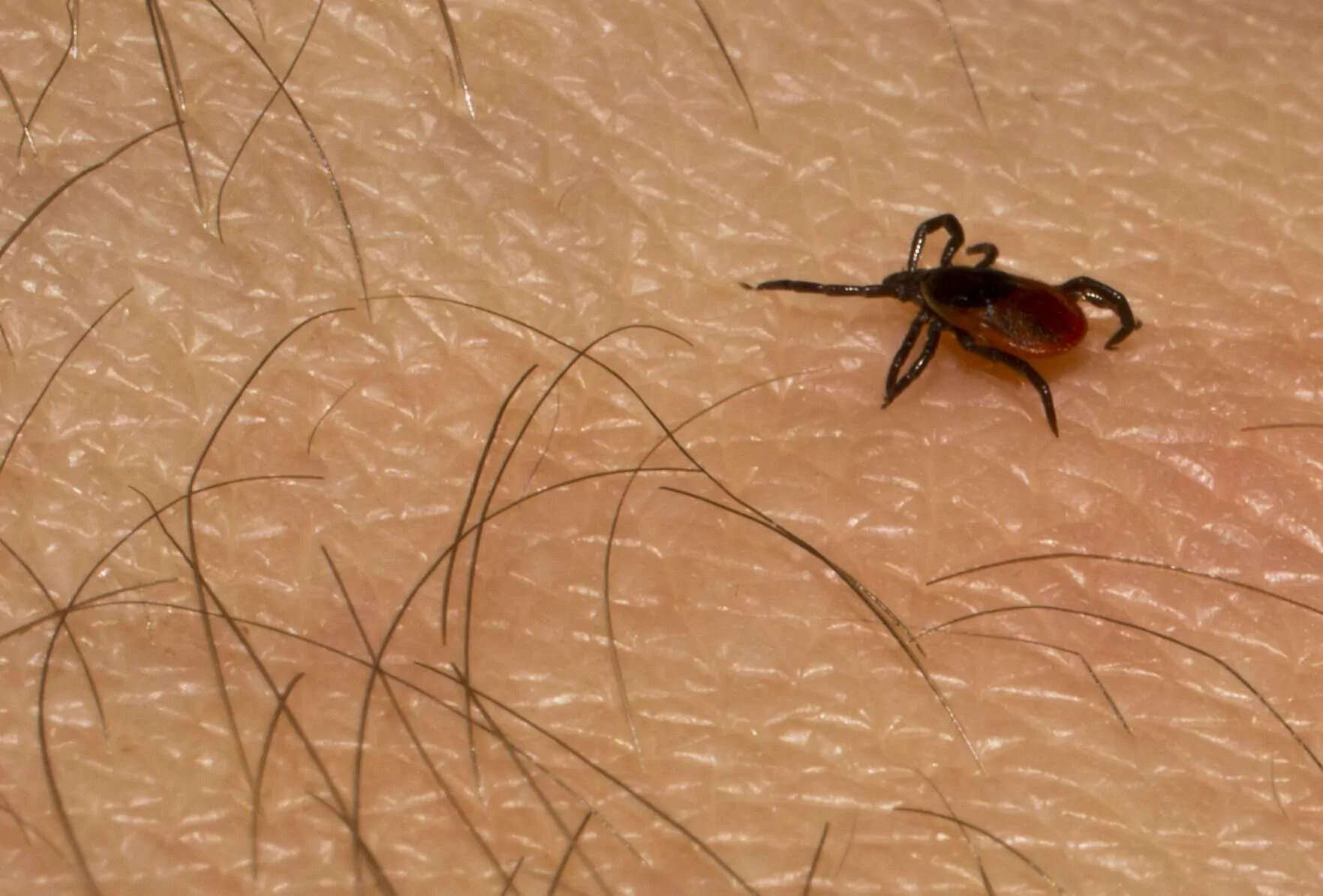 Magnified photo of a tick crawling across human skin